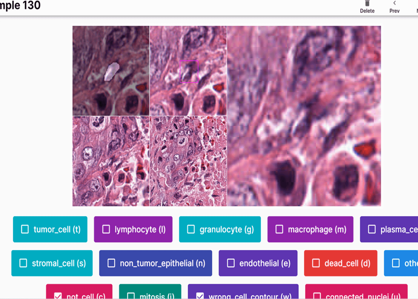 pathology-slide-7